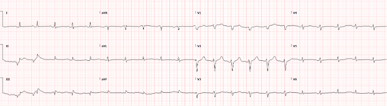 EKG+1.png
